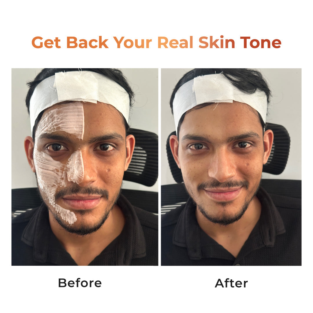 Niconi Tan Vanish Gluta-Kojic Skin Polish - B2B