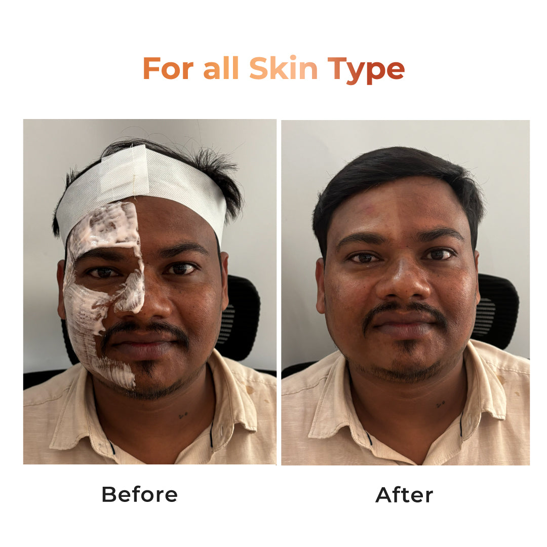 Niconi Tan Vanish Gluta-Kojic Skin Polish - Salon