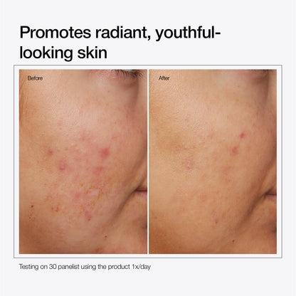 Niacinamide 10% + Zinc 1%