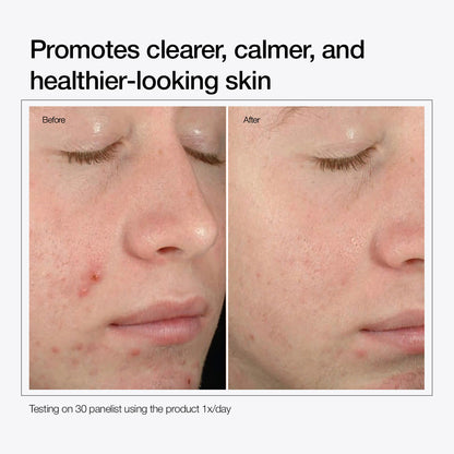 Salicylic Acid 2% Solution