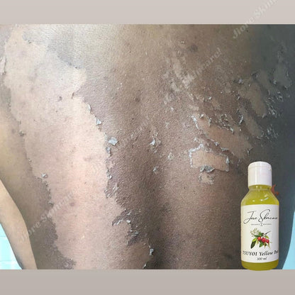 Jiore Tsuyoi Oil Skin Whitening Yellow Peel  Brightening & Exfoliating Treatment Skin