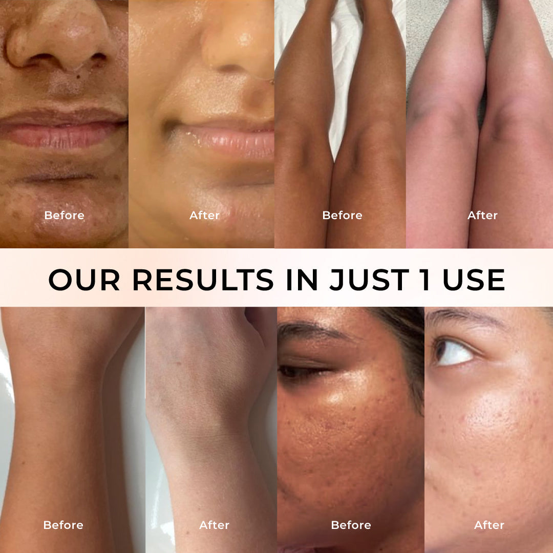 Niconi Tan Vanish Gluta-Kojic Skin Polish | Instant Tan Removal in under 20 minutes!